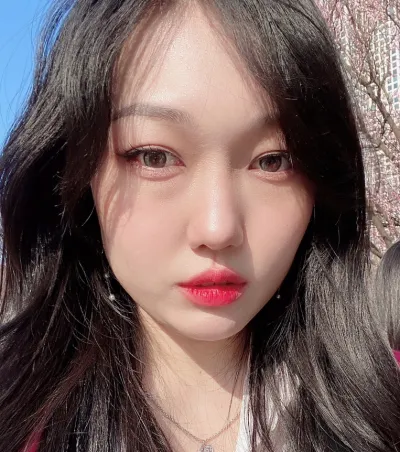 [눈] 샐리 - 눈밑지방재배치