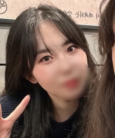 [눈] 오쪼쪼 - 절개쌍꺼풀 재수술