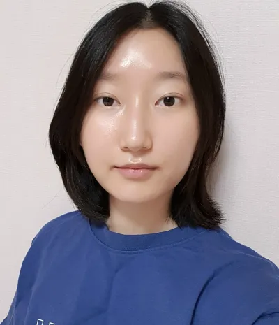 [눈] 계란말이 - 절개 눈매교정 재수술, 밑트임