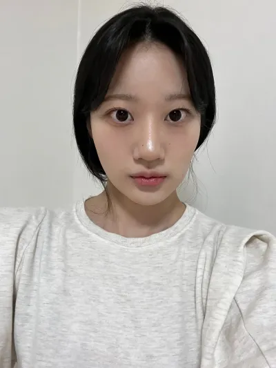 [눈] 다롱이 - 매몰쌍꺼풀, 비절개 눈매교정