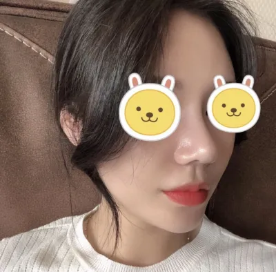 [코] 왕꼬부기 - 코