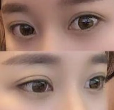 [눈] 꽃놀이갈래 - 눈매교정