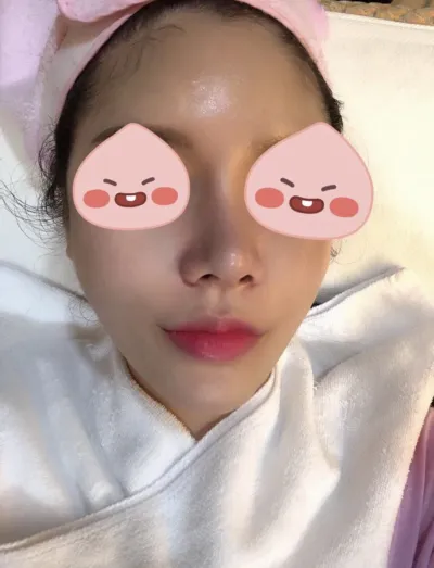 [피부] 왕꼬부기 - 슈링크