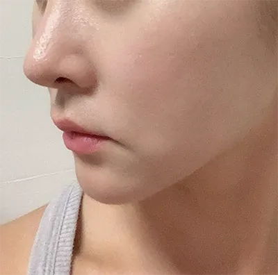 [쁘띠] 키야호1115 - 리프팅