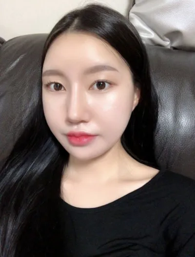 [안면윤곽] 지짖지지지지 - 안면윤곽,눈,코