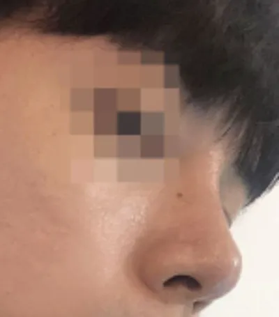 [코] 코즈802 - 콧대