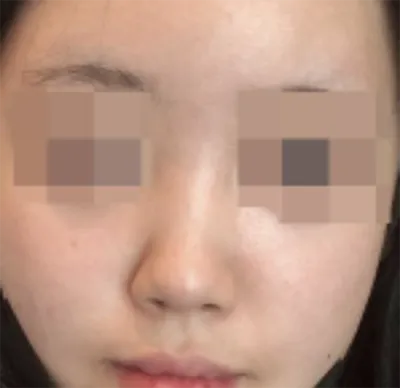 [코] 앙잉웅엉앙 - 코