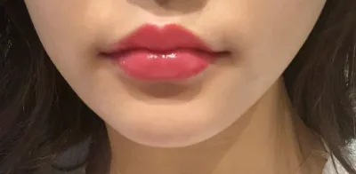 [쁘띠] 아머미 - 필러