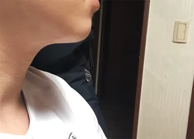 [피부] ㄱ강 - 슈링크