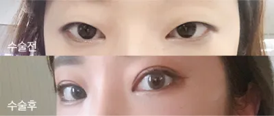 [눈] 은미까미 - 눈