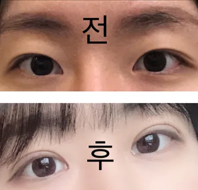 [눈] 양갱소푸 - 눈