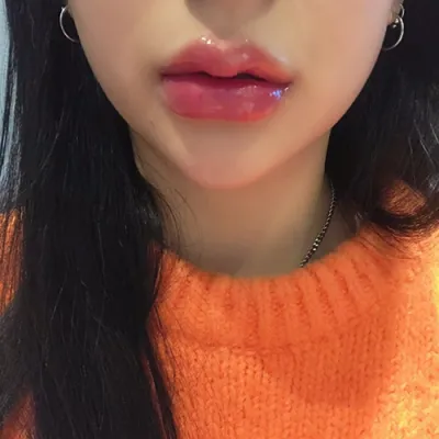 [쁘띠] naaa_ - 필러