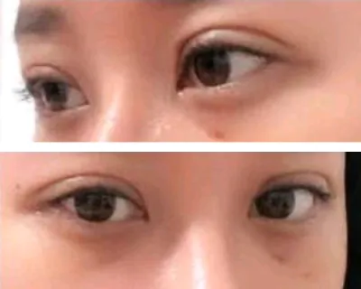 [눈] 로멘틱트리 - 눈