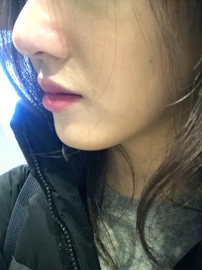 [쁘띠] si123 - 코조각주사