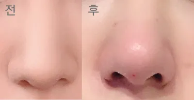 [쁘띠] tanatana0 - 코조각주사