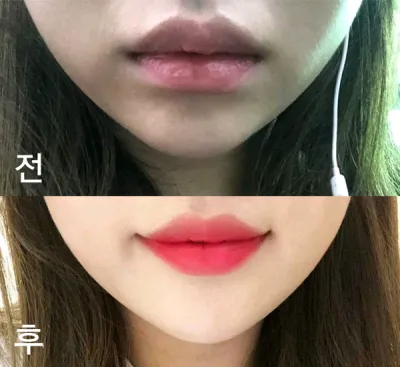 [쁘띠] 콘크롱이 - 입술필러