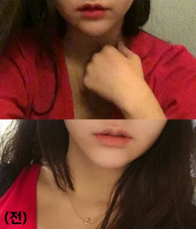 [쁘띠] ghyghy - 입술필러