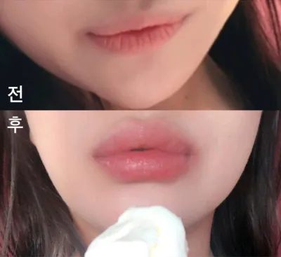 [쁘띠] bkbkbk - 입술필러