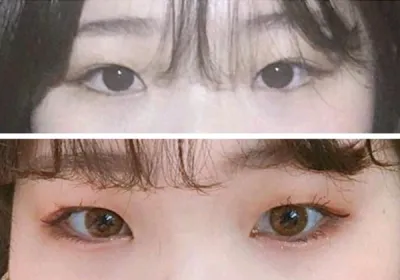 [눈] 구름이누나 - 눈