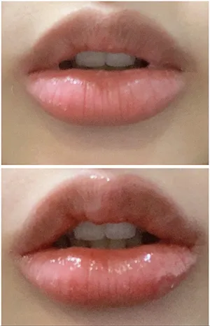 [쁘띠] 윤소리미 - 입술