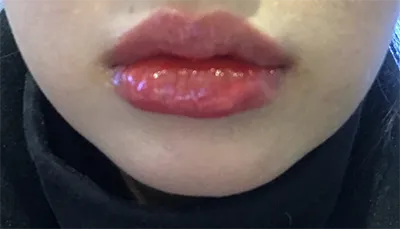 [쁘띠] 앙꼬 - 입술