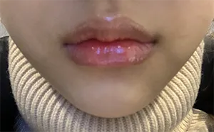 [쁘띠] ???? - 입술