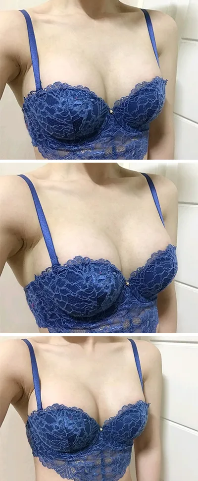 [가슴] ekehae - 가슴