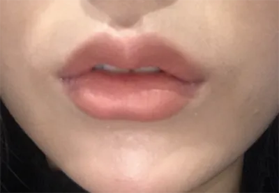 [쁘띠] lil887 - 입술