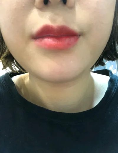 [쁘띠] 요술곤주 - 입술필러