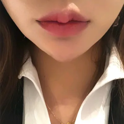 [쁘띠] 정느님 - 입술필러