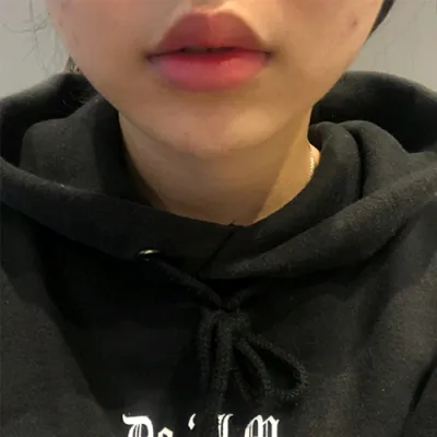 [쁘띠] 아1귀1찮ㅋ - 입술필러