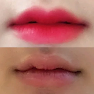 [쁘띠] sodh - 입술필러