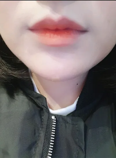 [쁘띠] kkd0229 - 입술필러