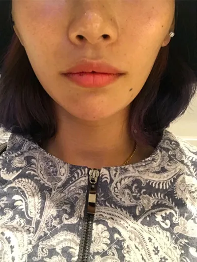 [쁘띠] 화장하는고양이 - 입술필러,보톡스