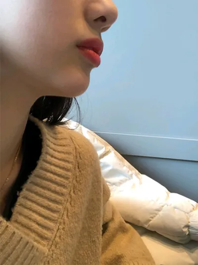 [쁘띠] fdksk - 턱필러