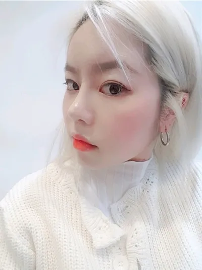 [코] 왕눈이00 - 코, 눈, 지방이식