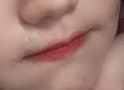 [쁘띠] vv림b27 - 입술필러