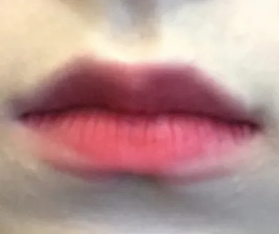 [쁘띠] 쌍수성공쓰 - 입술필러