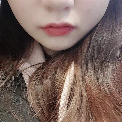 [쁘띠] 장이야아 - 슈링크, 보톡스