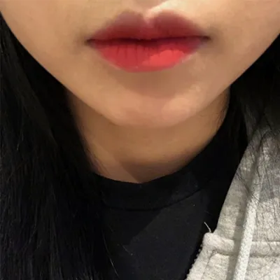 [쁘띠] 이1쁘듀 - 입꼬리필러,보톡스