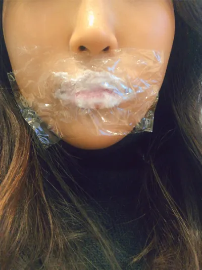 [쁘띠] hyb - 입술필러,보톡스