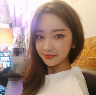 [눈] 메이123 - 눈, 지방이식