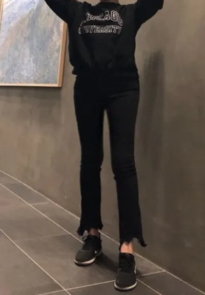 [지방흡입] 꺅긱꺅 - 지방흡입