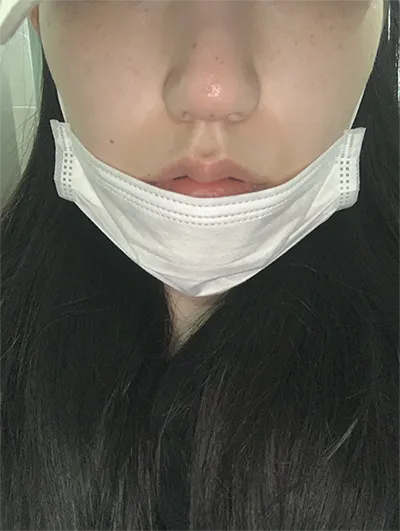 [쁘띠] 햇빛55 - 코