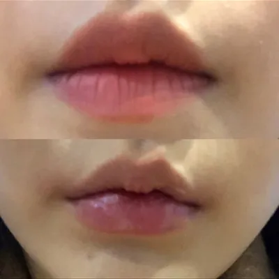 [쁘띠] 찌닝니니 - 입술