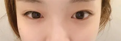 [눈] 푸른곰도리 - 눈