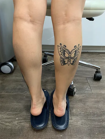 [쁘띠] 제니03 - 종아리