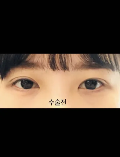 [눈] 주히95 - 눈