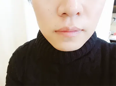 [쁘띠] 런리런리 - 리프팅