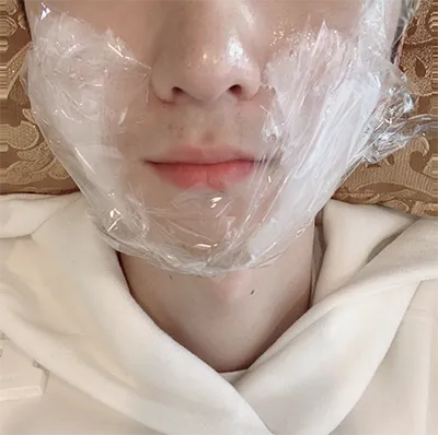 [피부] 왕밤빵단팥빵 - 슈링크, 윤곽주사